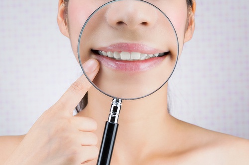 Paradontologische Behandlung mit der gesteuerten Geweberegeneration bei ALL DENTE.