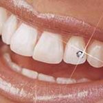 Ästhetischer Zahnschmuck auf den Zähnen einer Frau.
