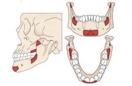 Die Grafik zeigt die Kiefer- und Zahnstruktur.