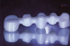Das vorgefertigte Brückengerüst aus Zirkonoxid-Keramik wird in unserem hauseigenen Labor von ALL DENTE hergestellt.