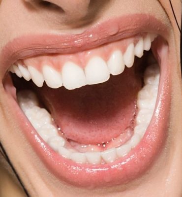 wurzelbehandlung-implantat-veranstaltung Strahlendes Lächeln Implantaten oder Wurzelbehandlung.