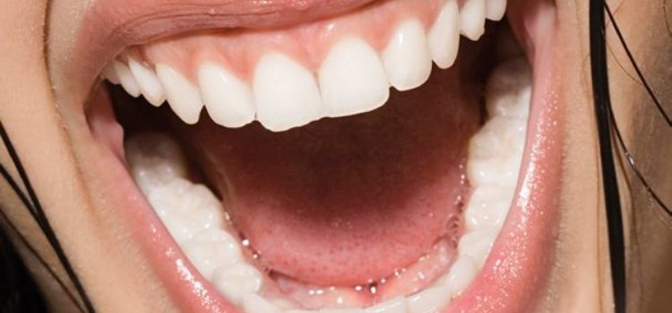 wurzelbehandlung-implantat-veranstaltung Strahlendes Lächeln Implantaten oder Wurzelbehandlung.